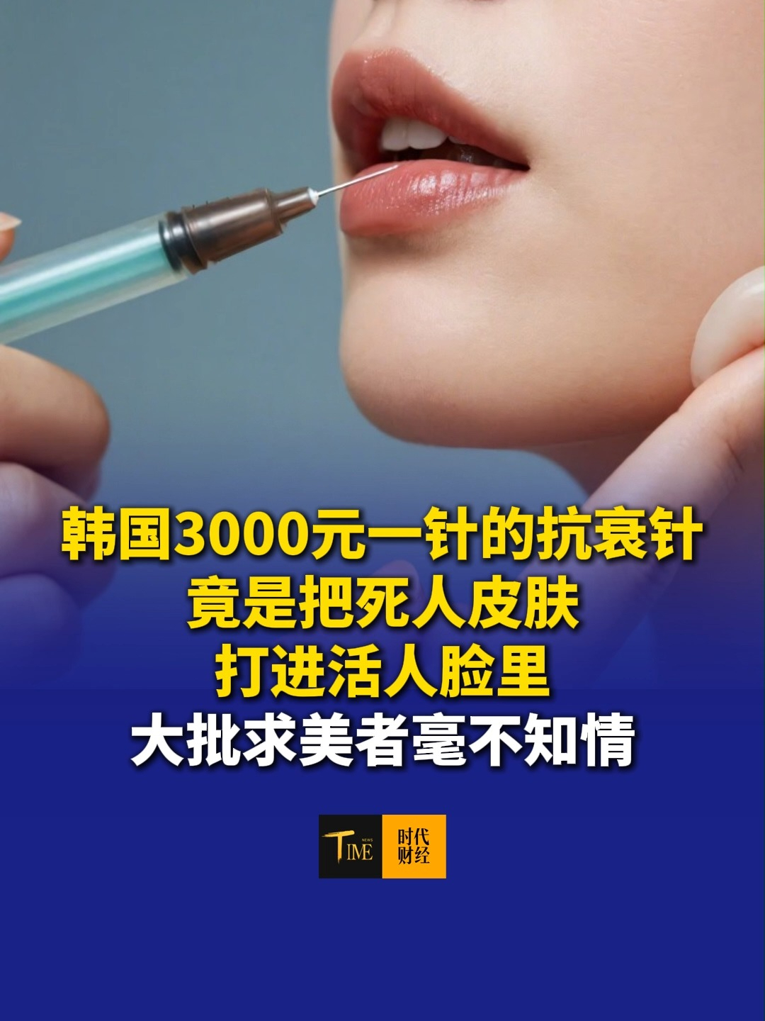 韩国3000元一针的抗衰针，竟是把死人皮肤打进活人脸里，大批求美者毫不知情，专家指出，细胞可能会携带捐献者的基因片段。万一捐献者患有遗传病，会对求美者健康造成风险。